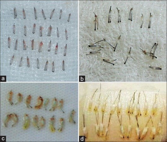 , &Epsilon;&nu;&alpha;&lambda;&lambda;&alpha;&kappa;&tau;&iota;&kappa;έ&sigmaf; &pi;&eta;&gamma;έ&sigmaf; &delta;&omega;&rho;&eta;&tau;ώ&nu; &mu;&alpha;&lambda;&lambda;&iota;ώ&nu;