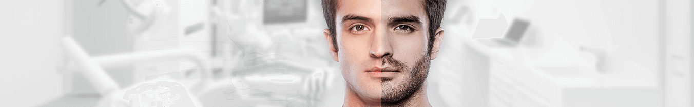 Beard Transplant, BEARD TRANSPLANT