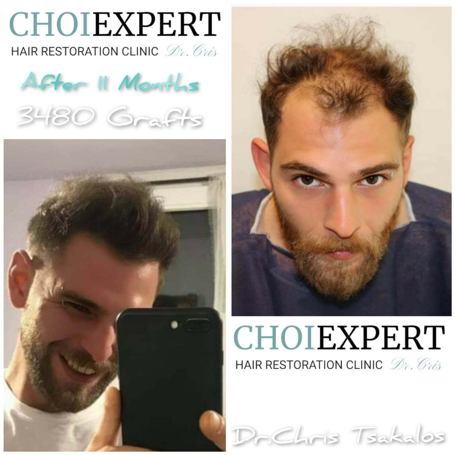 Haartransplantationsklinik, Home