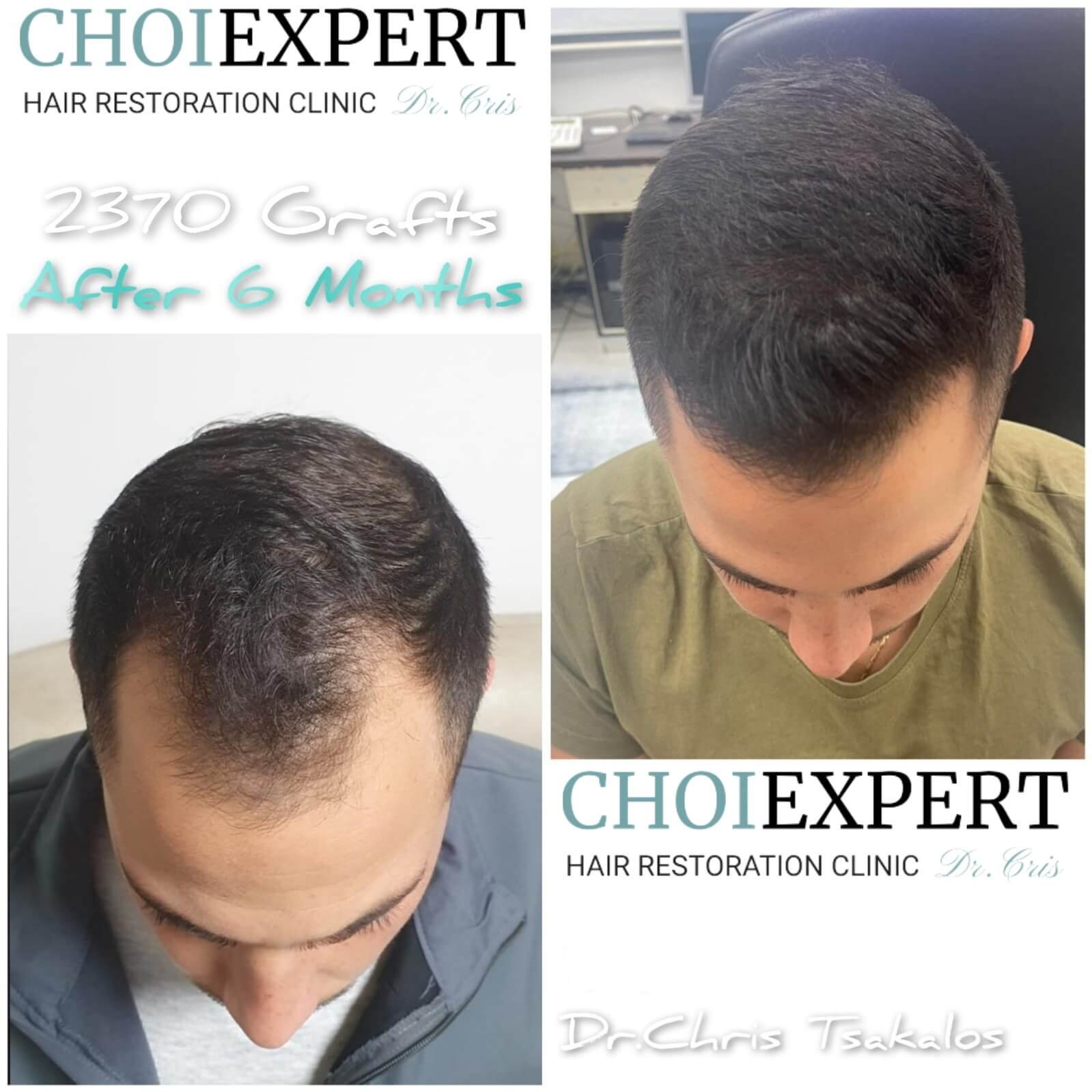 Haartransplantationsklinik, Home