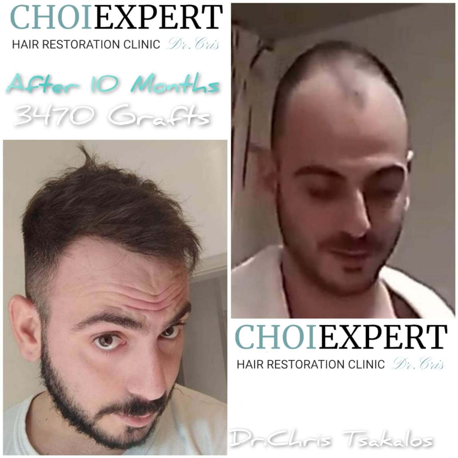 Haartransplantationsklinik, Home