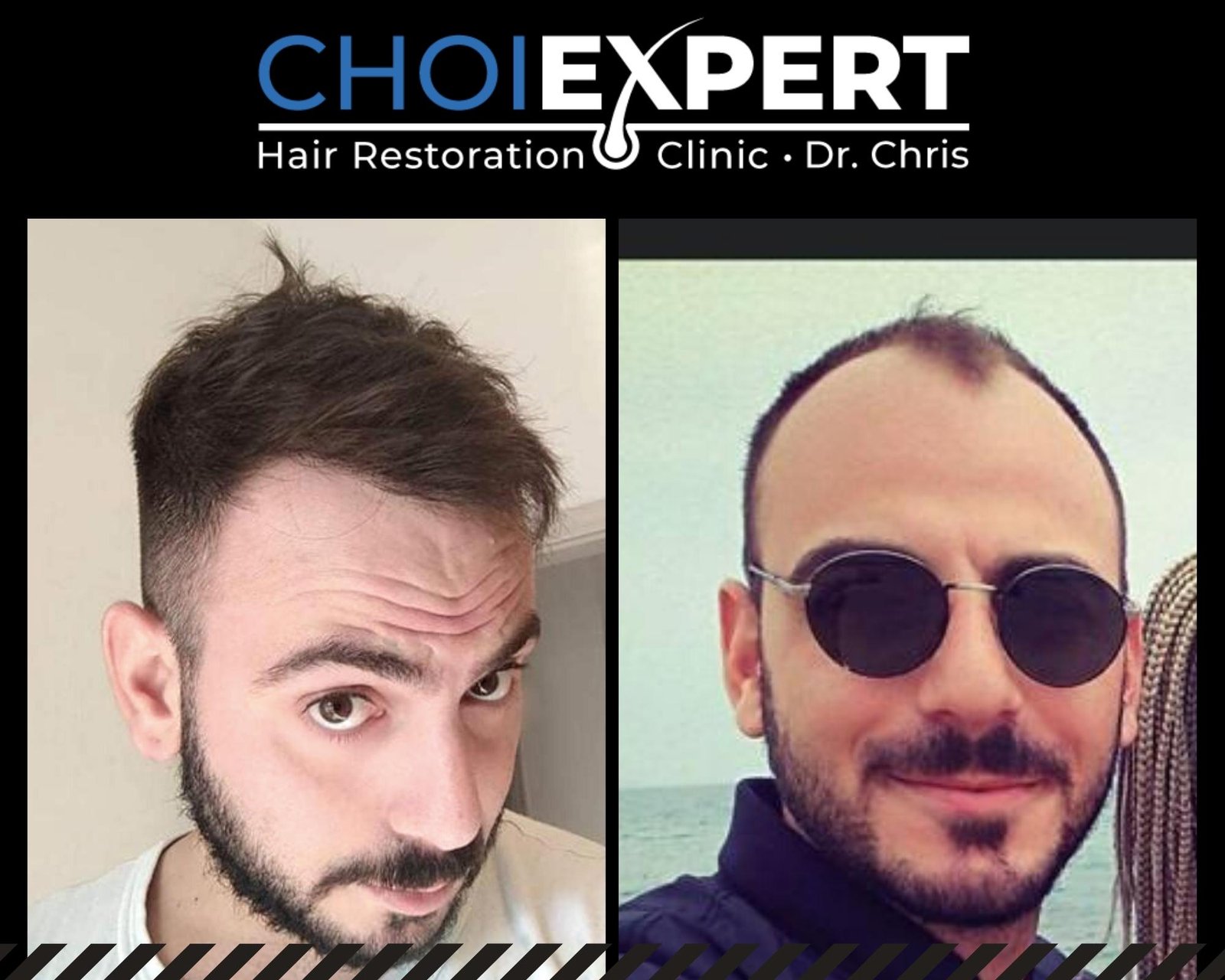 , Risultati prima e dopo