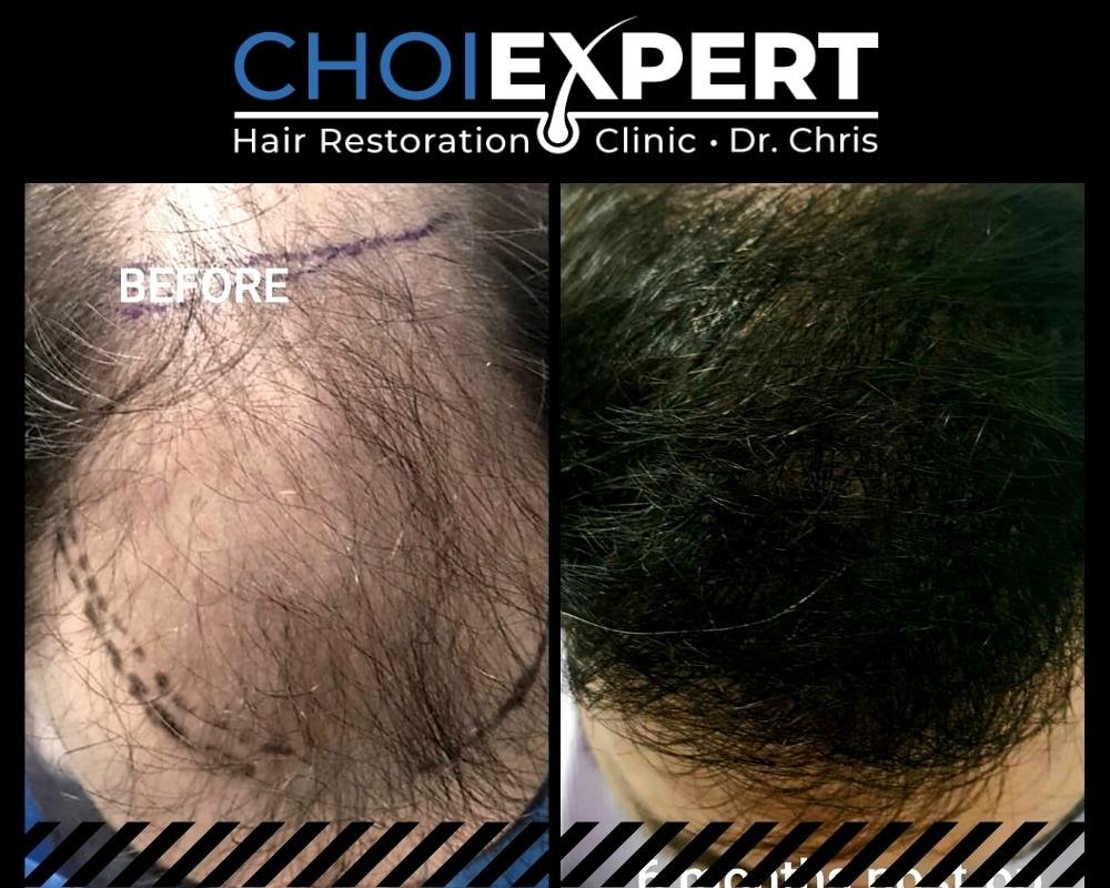 , Risultati prima e dopo