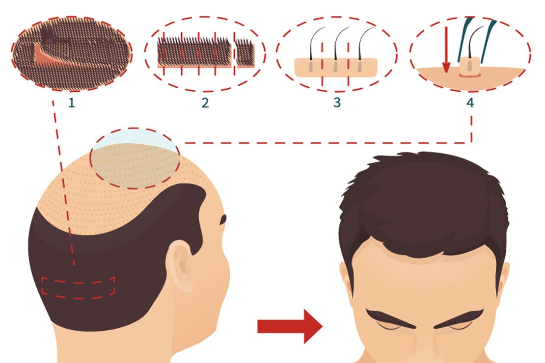 , &Sigma;&Upsilon;&Gamma;&Kappa;&Rho;&Iota;&Sigma;&Eta; &Tau;&Epsilon;&Chi;&Nu;&Iota;&Kappa;&Omega;&Nu;