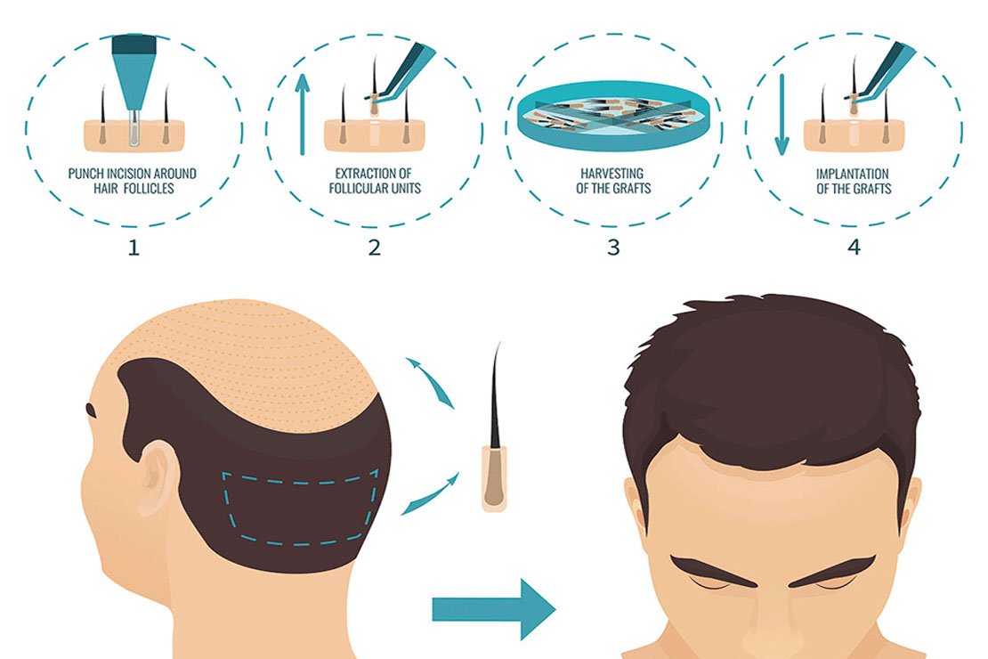 , &Sigma;&Upsilon;&Gamma;&Kappa;&Rho;&Iota;&Sigma;&Eta; &Tau;&Epsilon;&Chi;&Nu;&Iota;&Kappa;&Omega;&Nu;