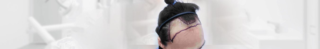 , &Alpha;&Nu;&Delta;&Rho;&Epsilon;&Sigma; & &Gamma;&Upsilon;&Nu;&Alpha;&Iota;&Kappa;&Epsilon;&Sigma; &Alpha;&Kappa;&Upsilon;&Rho;&Epsilon;&Sigma; &Mu;&Alpha;&Lambda;&Lambda;&Iota;&Epsilon;&Sigma; &Mu;&Epsilon;&Tau;&Alpha;&Mu;&Omicron;&Sigma;&Chi;&Epsilon;&Upsilon;&Sigma;&Eta;