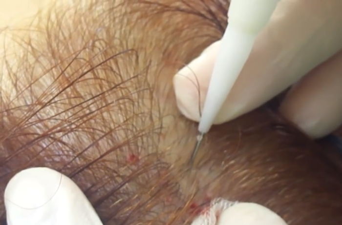 , &Alpha;&Nu;&Delta;&Rho;&Epsilon;&Sigma; & &Gamma;&Upsilon;&Nu;&Alpha;&Iota;&Kappa;&Epsilon;&Sigma; &Alpha;&Kappa;&Upsilon;&Rho;&Epsilon;&Sigma; &Mu;&Alpha;&Lambda;&Lambda;&Iota;&Epsilon;&Sigma; &Mu;&Epsilon;&Tau;&Alpha;&Mu;&Omicron;&Sigma;&Chi;&Epsilon;&Upsilon;&Sigma;&Eta;