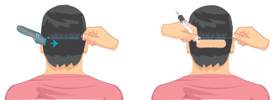 , &Alpha;&Nu;&Delta;&Rho;&Epsilon;&Sigma; & &Gamma;&Upsilon;&Nu;&Alpha;&Iota;&Kappa;&Epsilon;&Sigma; &Alpha;&Kappa;&Upsilon;&Rho;&Epsilon;&Sigma; &Mu;&Alpha;&Lambda;&Lambda;&Iota;&Epsilon;&Sigma; &Mu;&Epsilon;&Tau;&Alpha;&Mu;&Omicron;&Sigma;&Chi;&Epsilon;&Upsilon;&Sigma;&Eta;