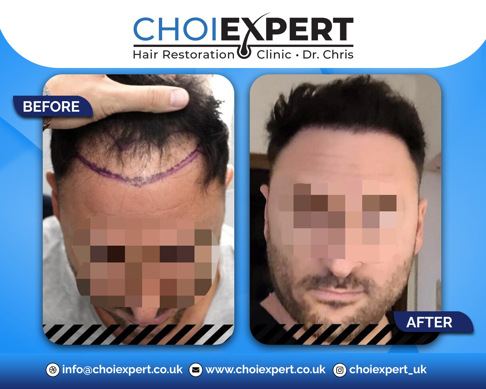 , Before & After Results