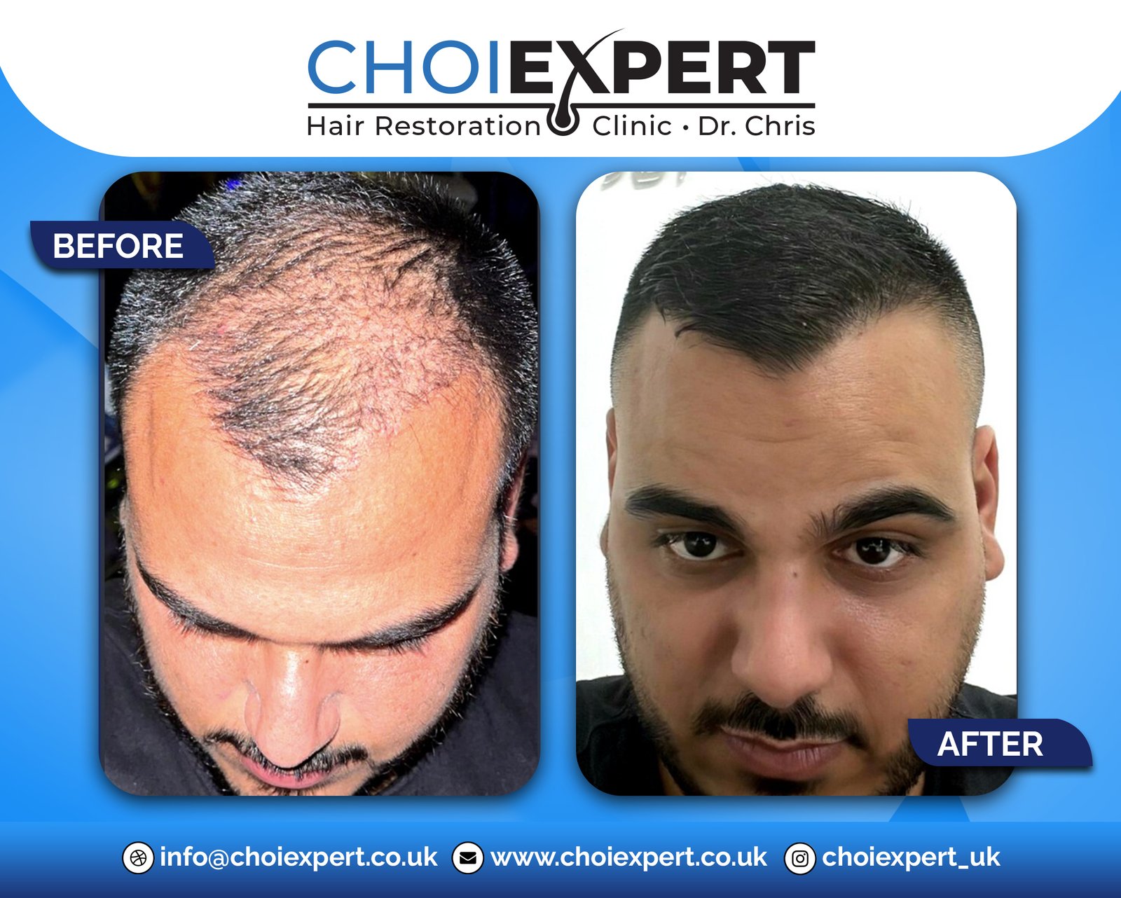 , Before & After Results