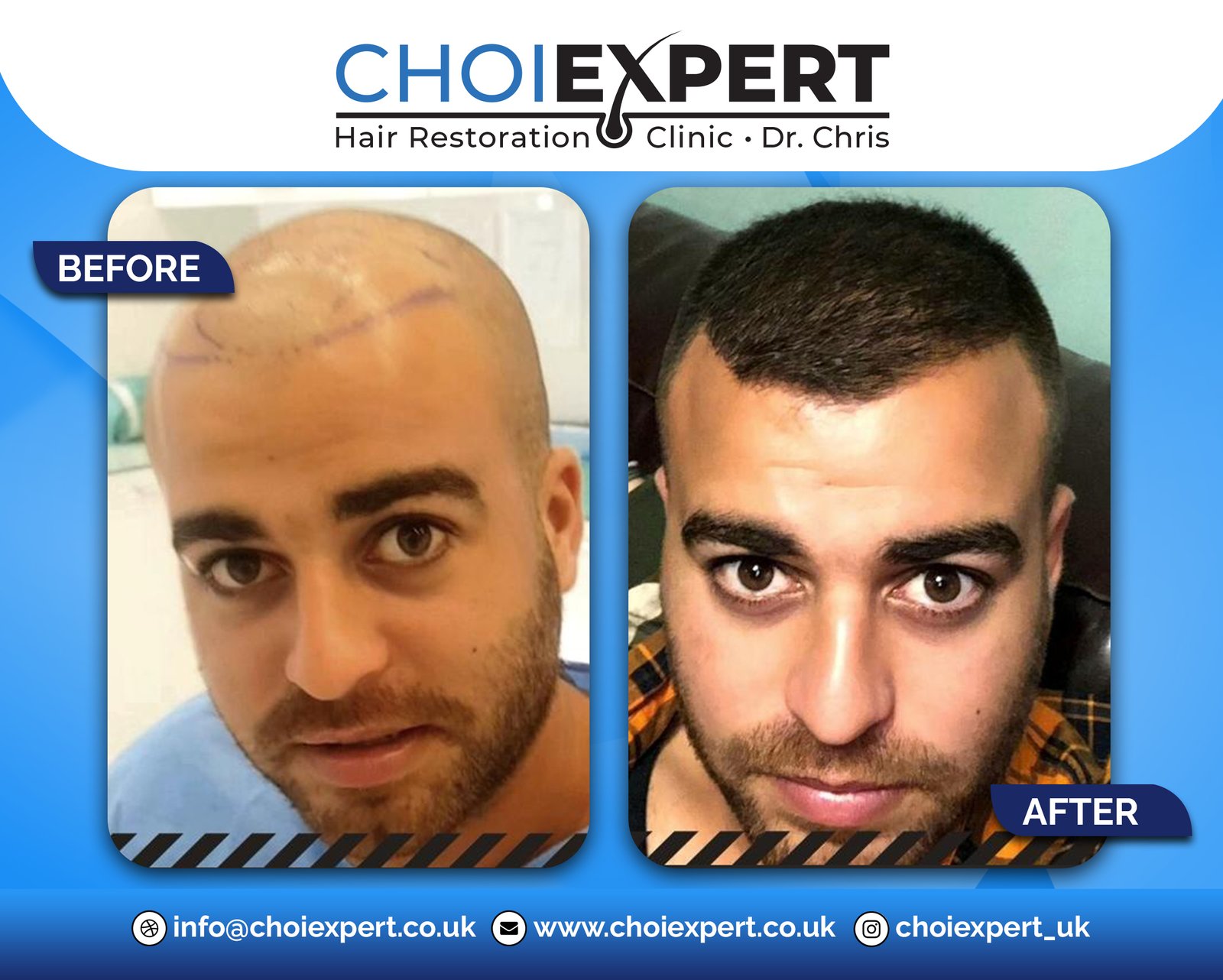 , Before & After Results