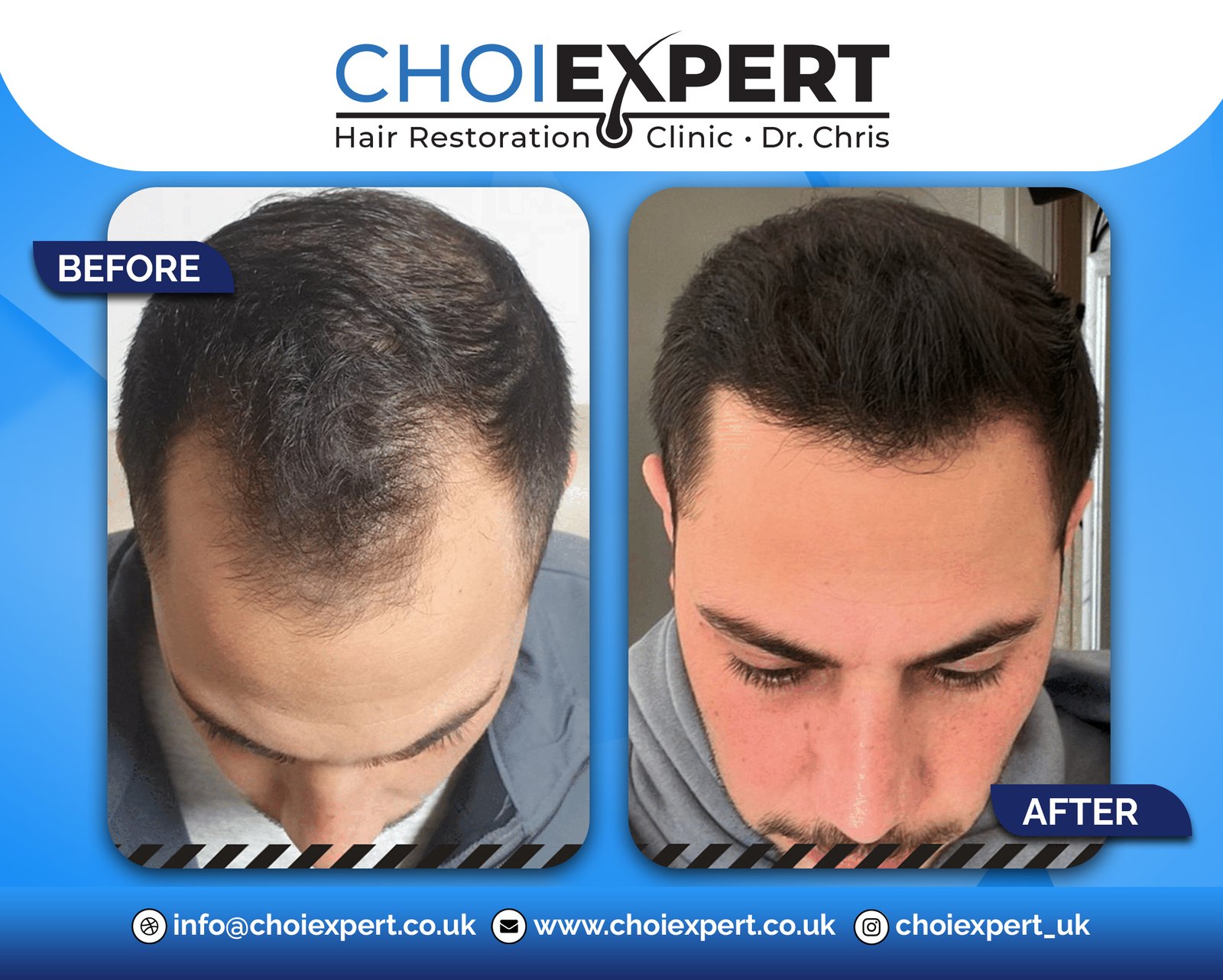 Hair Transplant Clinic, &Sigma;&pi;ί&tau;&iota;