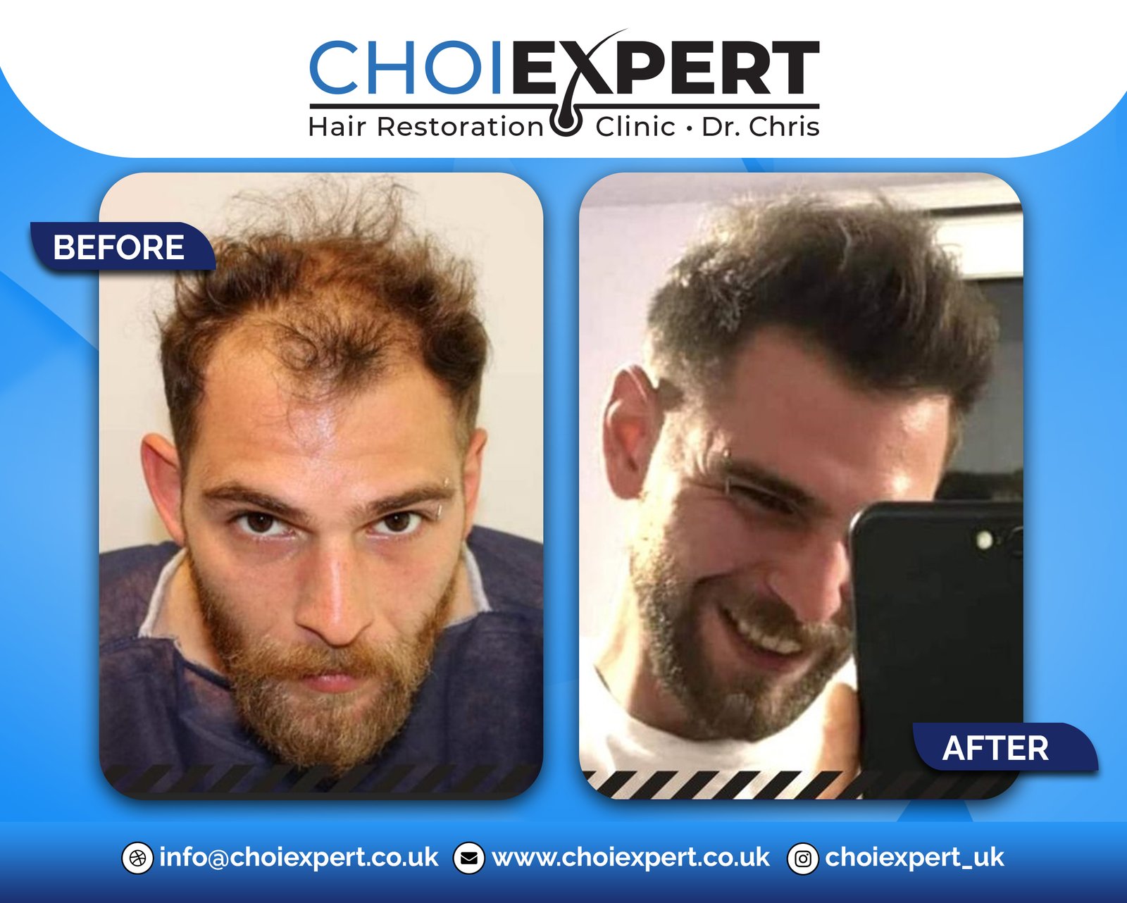 Hair Transplant Clinic, &Sigma;&pi;ί&tau;&iota;