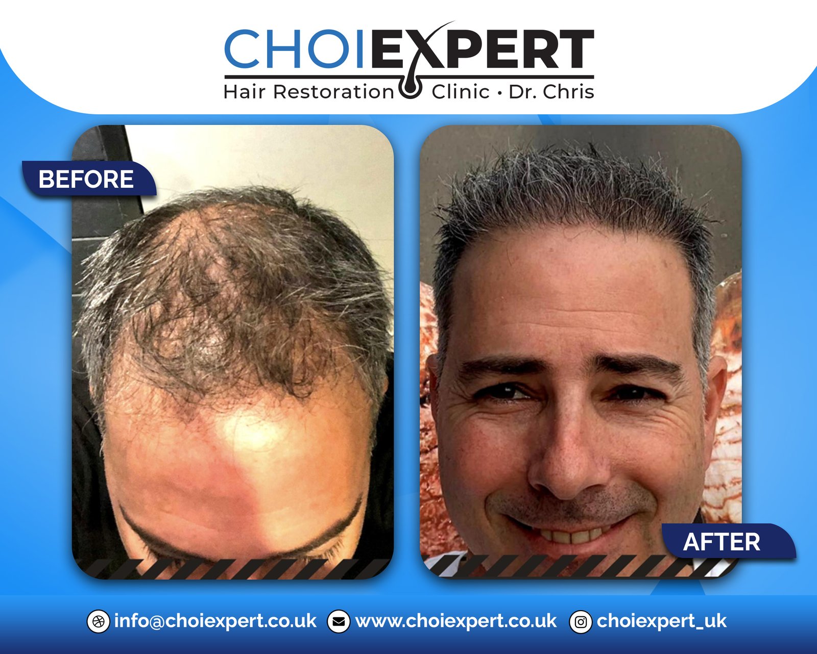 , Before & After Results