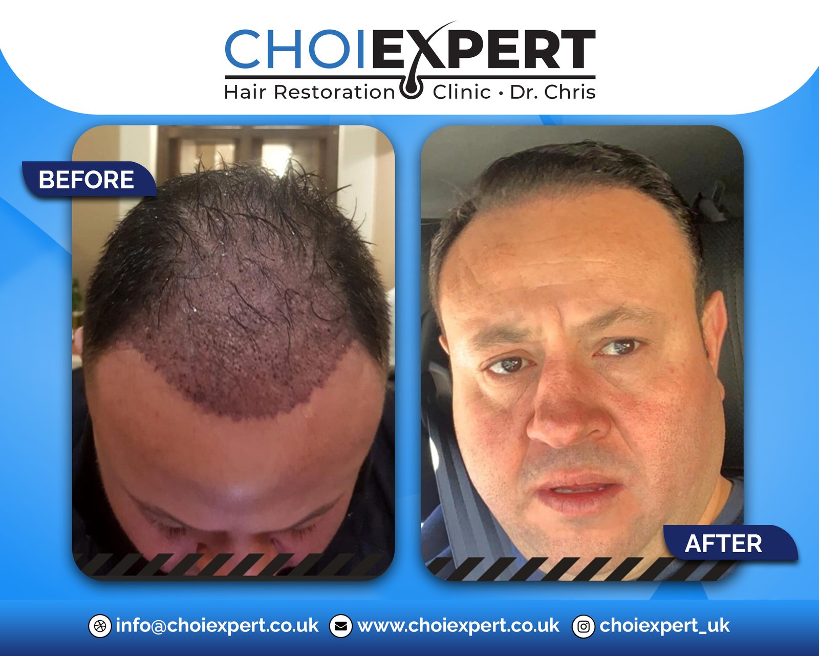 , Before & After Results