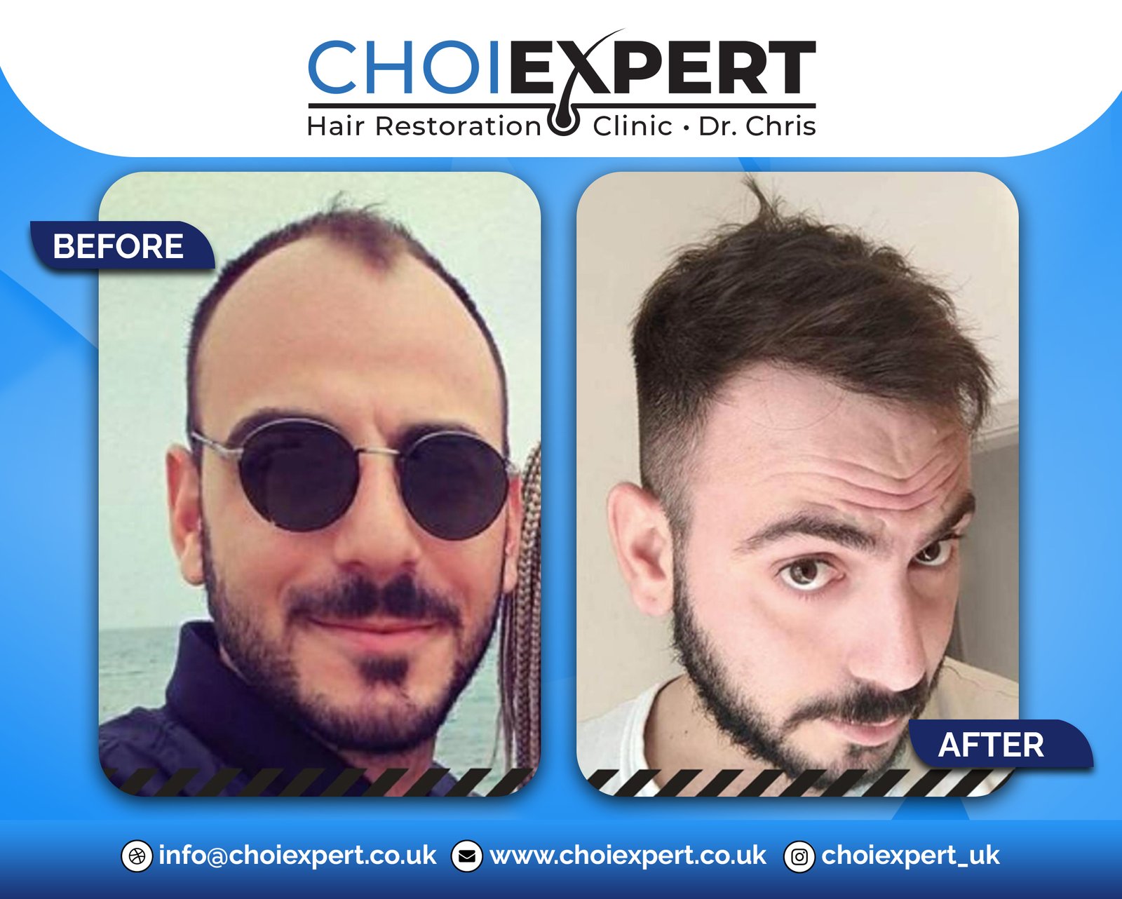 Hair Transplant Clinic, &Sigma;&pi;ί&tau;&iota;