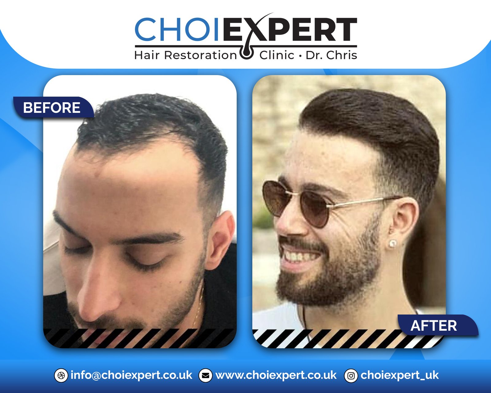 , Before & After Results