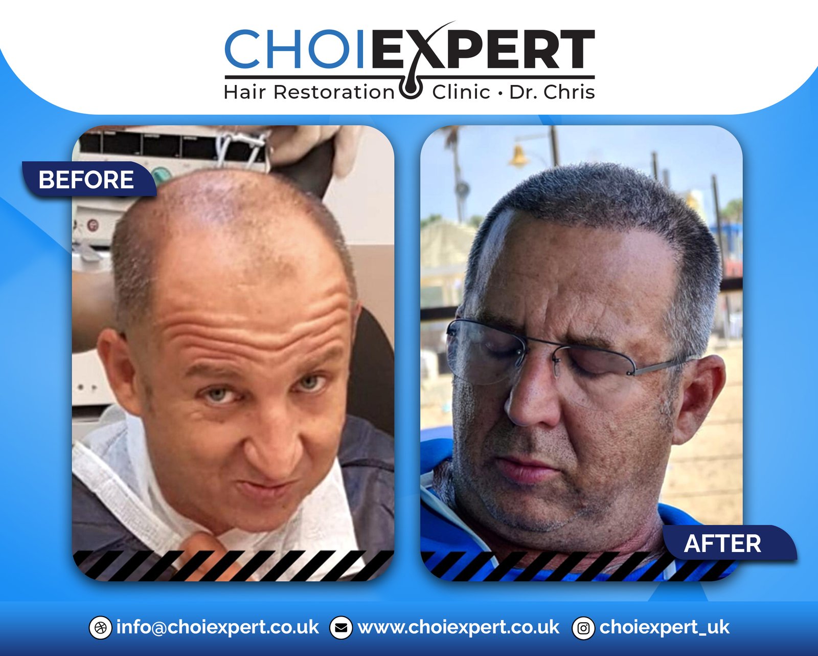 , Before & After Results