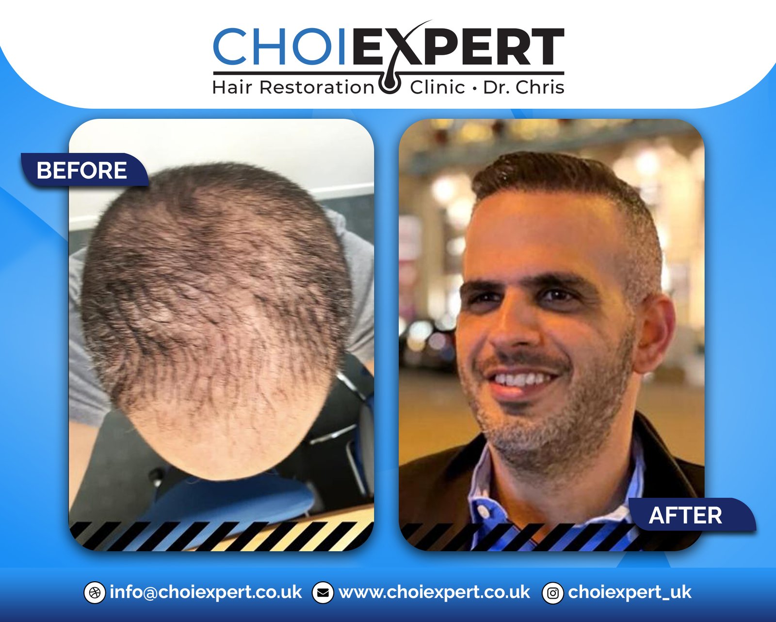 , Before & After Results