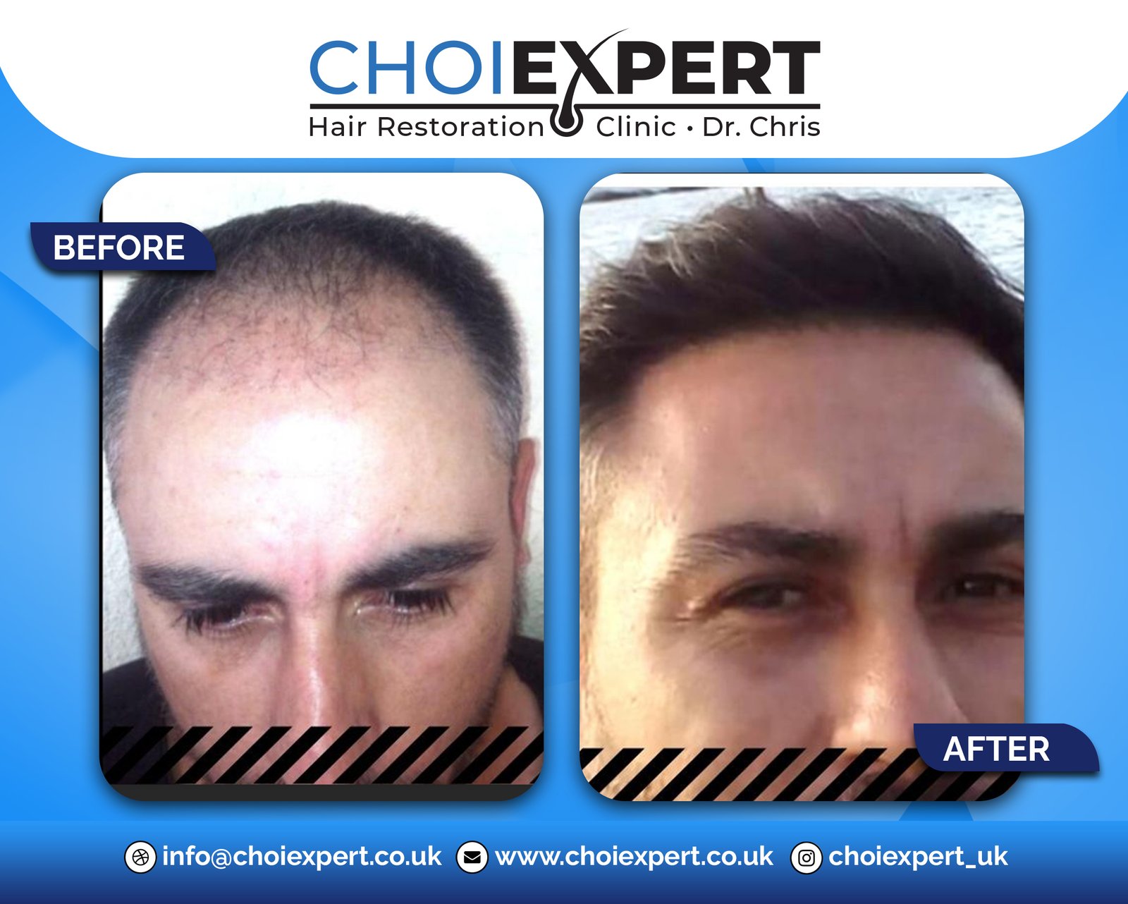 , Before & After Results