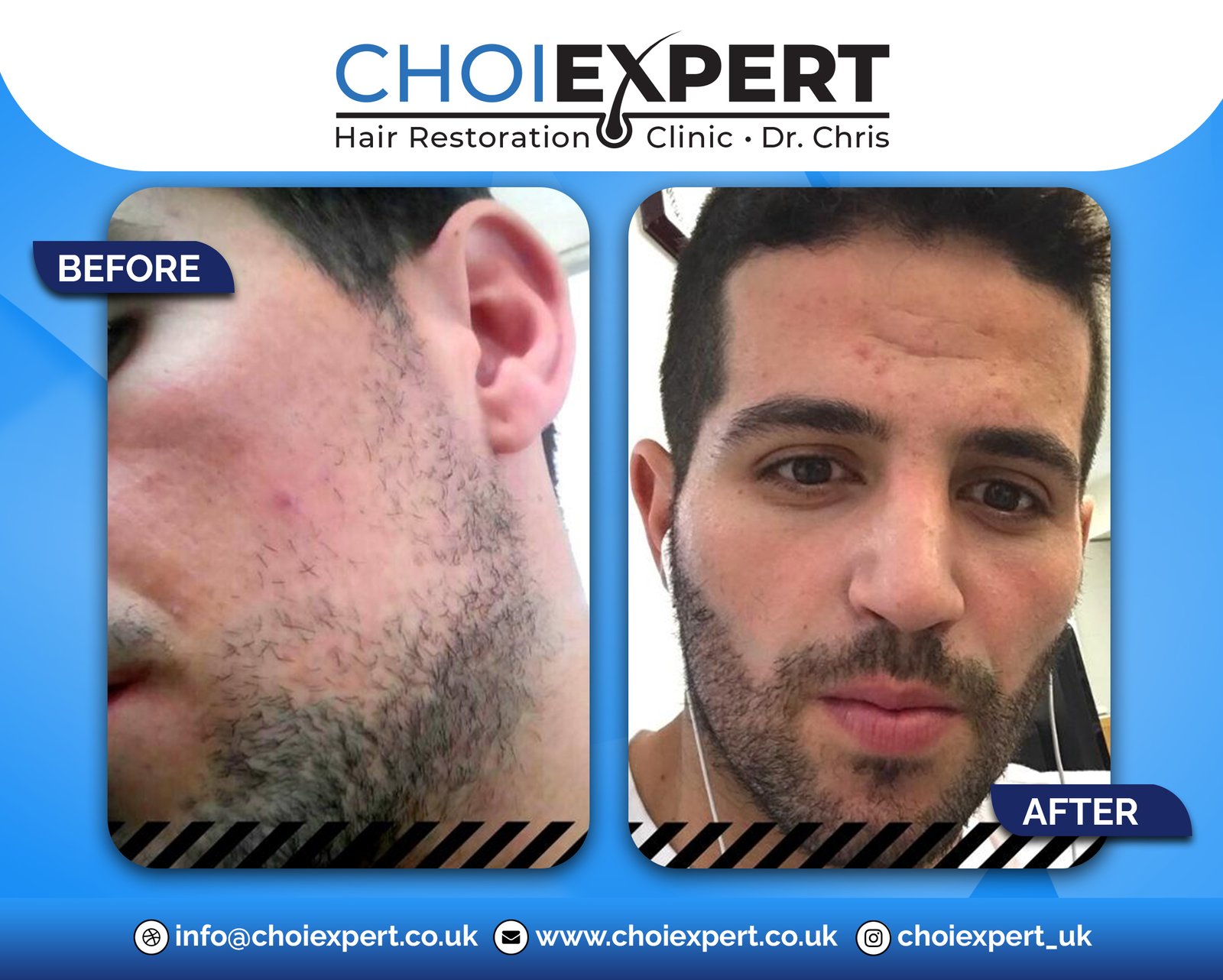 , Before & After Results