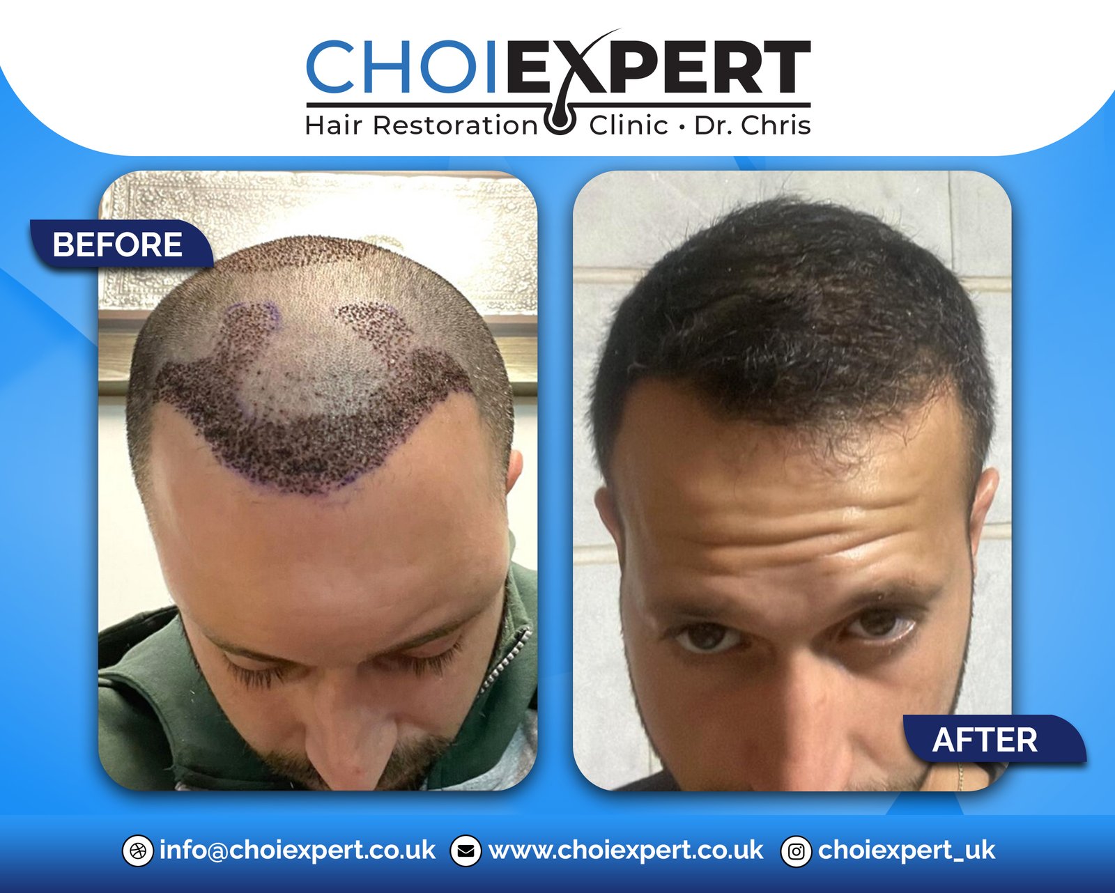 , Before & After Results