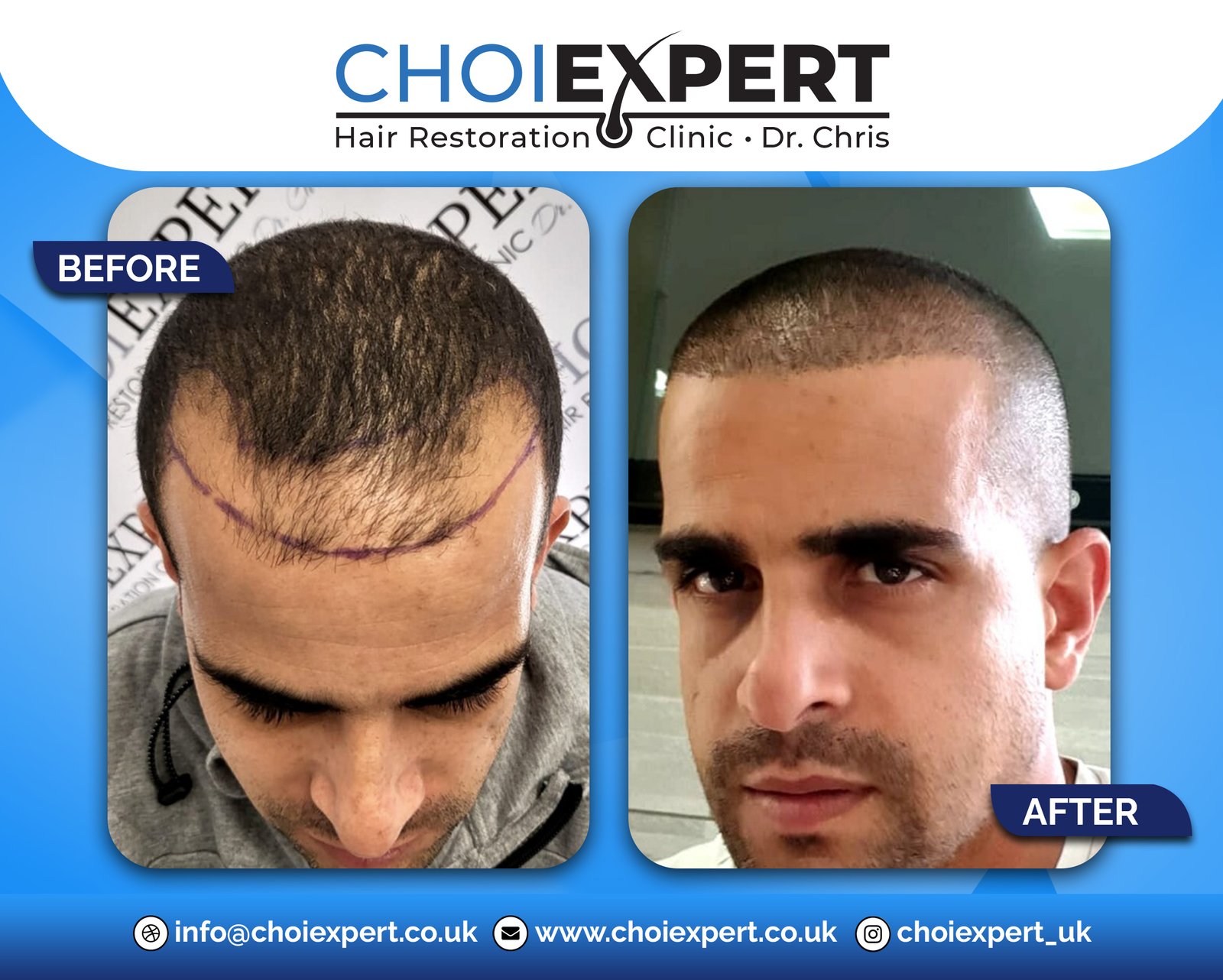 , Before & After Results