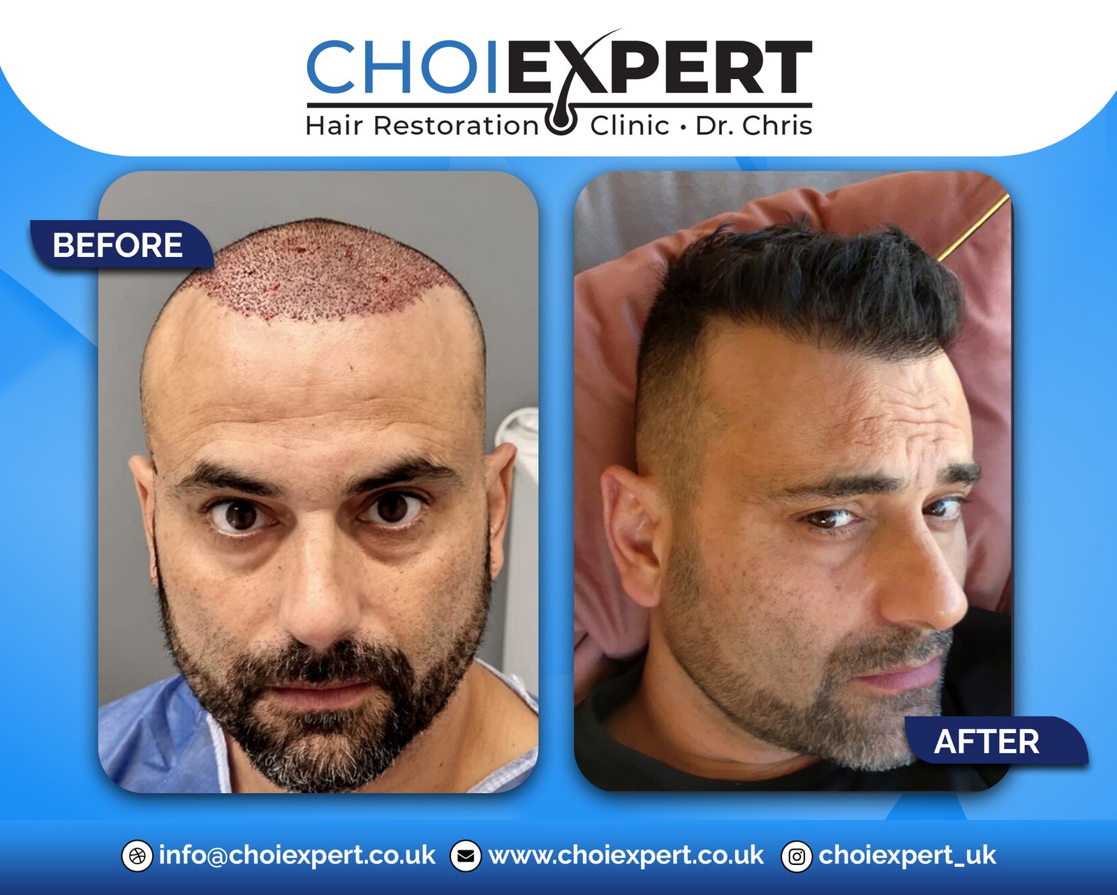 , Before & After Results