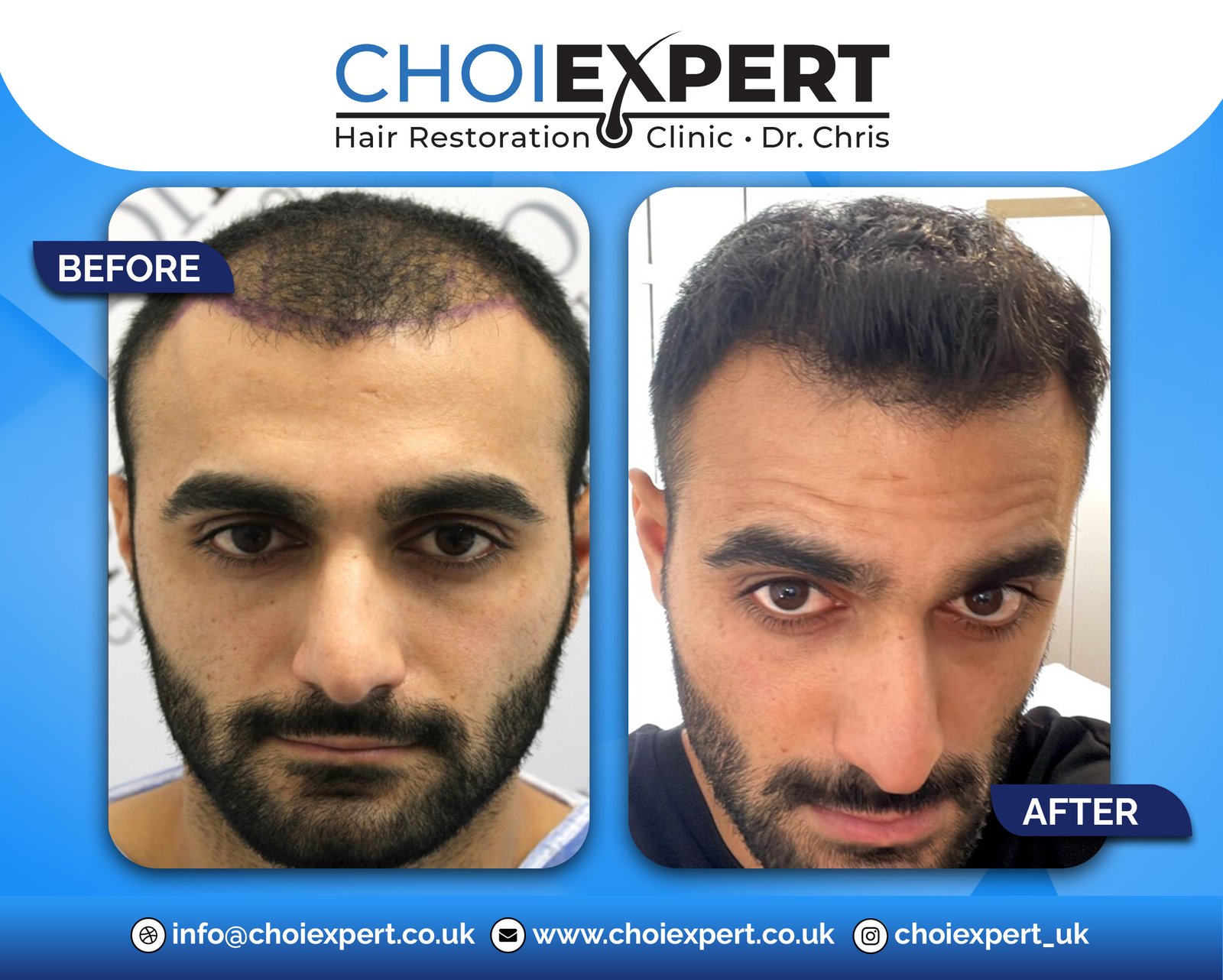 , Before & After Results