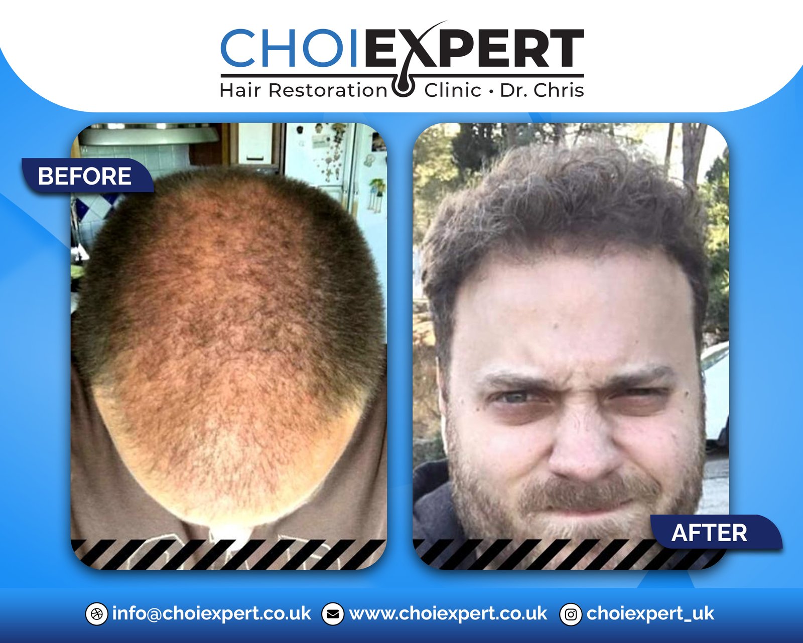 , Before & After Results