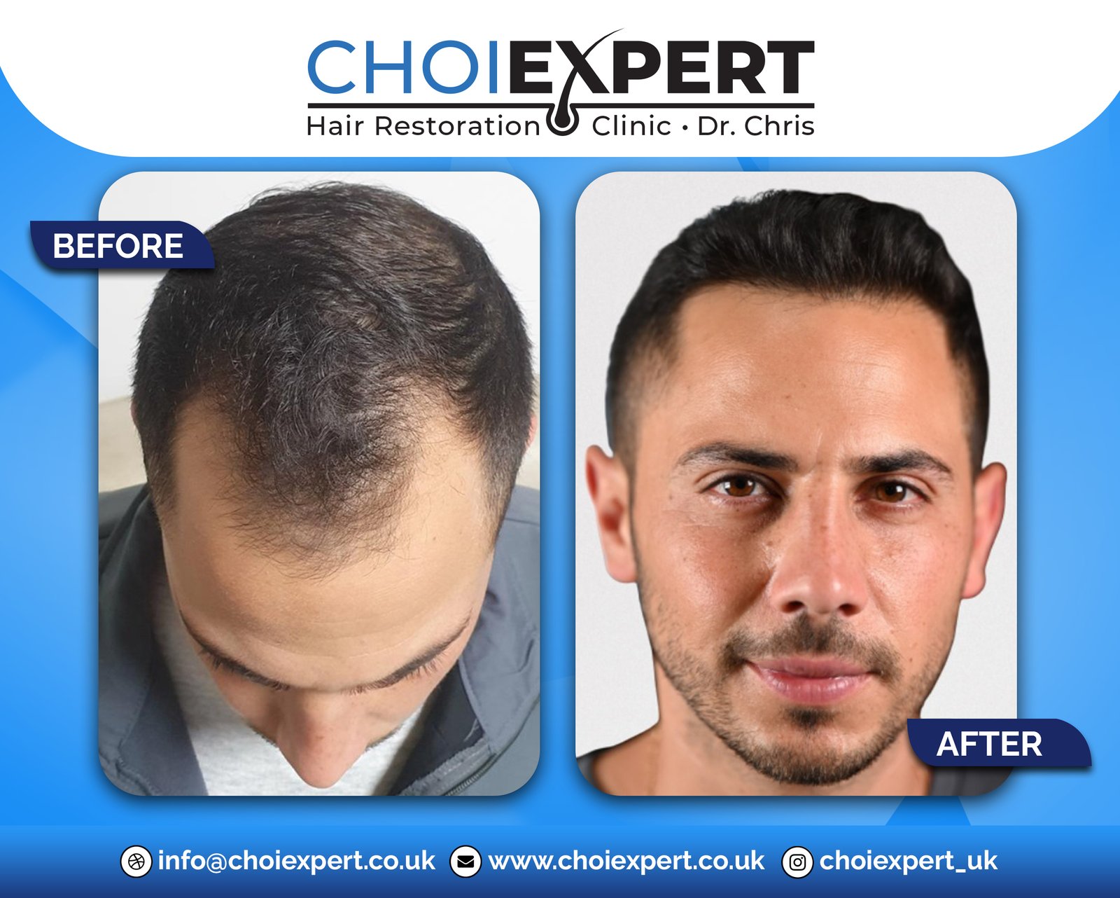 , Before & After Results