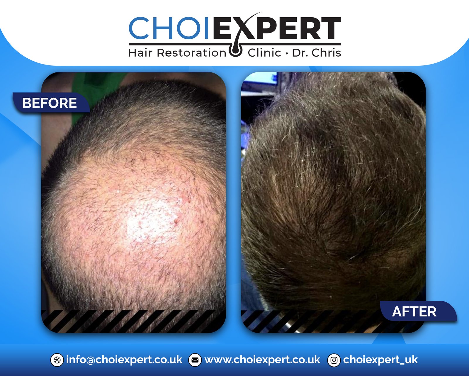 , Before & After Results