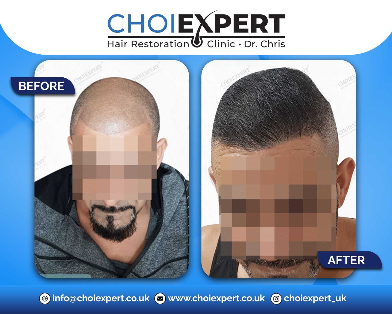 , Before & After Results