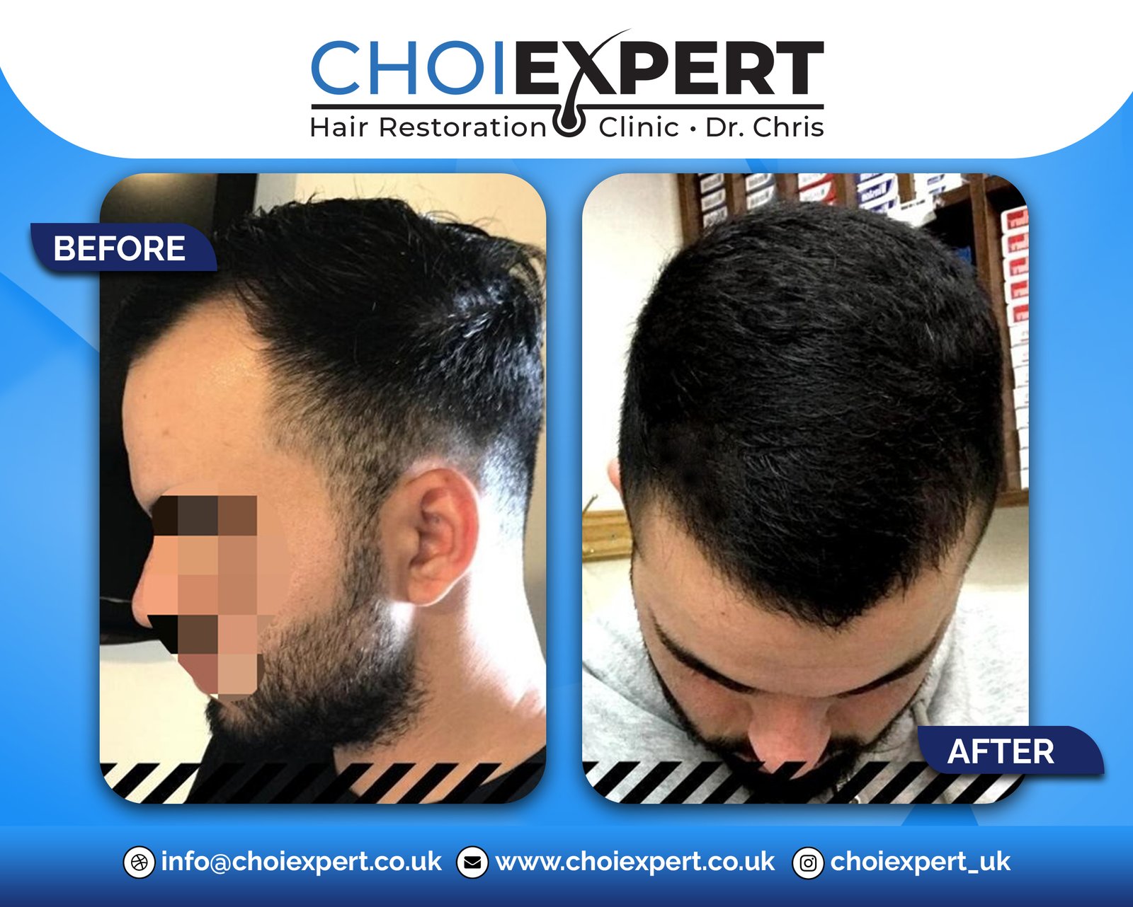 , Before & After Results