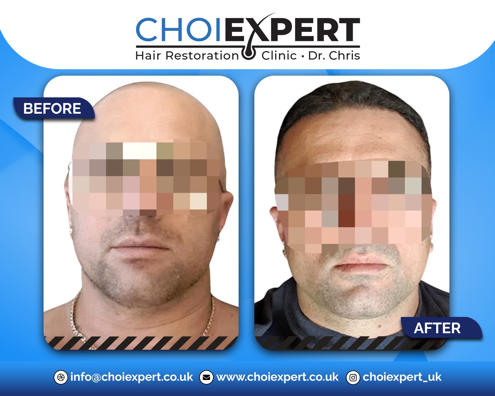 , Before & After Results