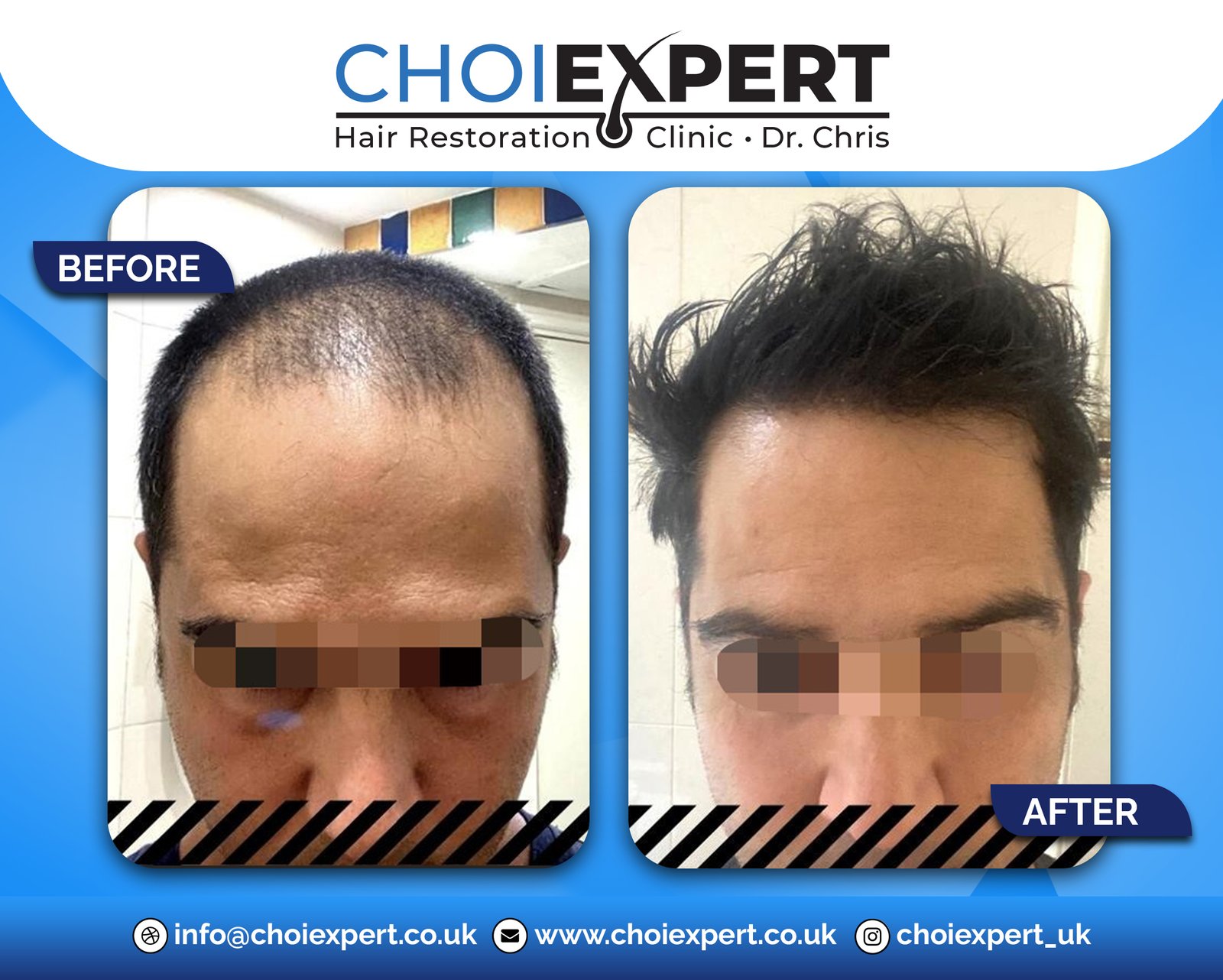 , Before & After Results