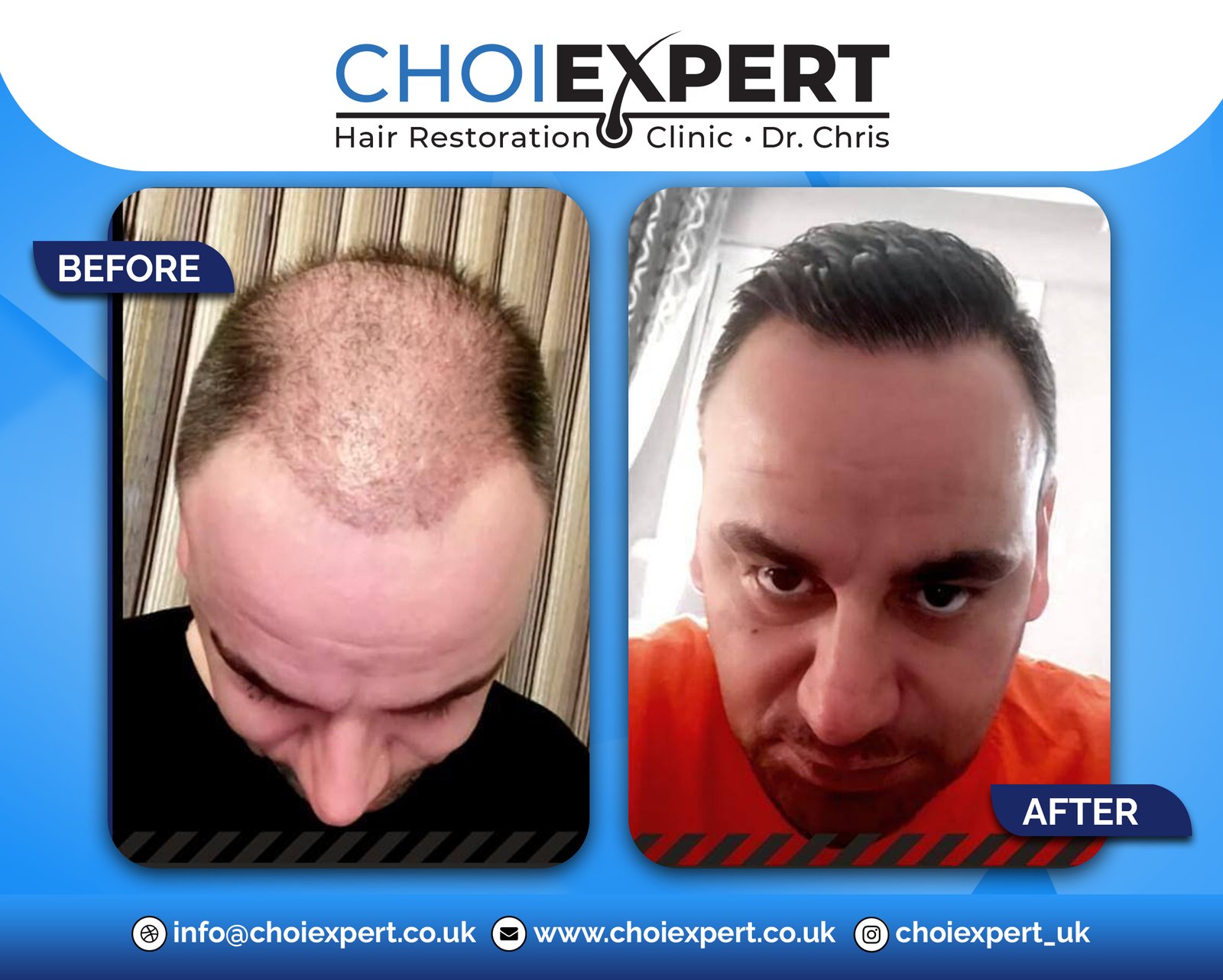 , Before & After Results