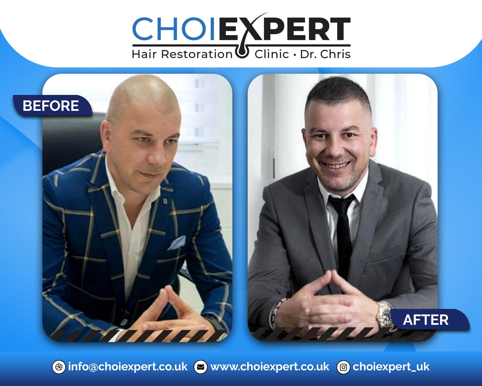 , Before & After Results